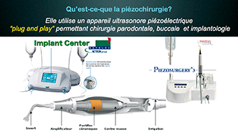 Fig. 1 : Principes de la piezochirurgie.