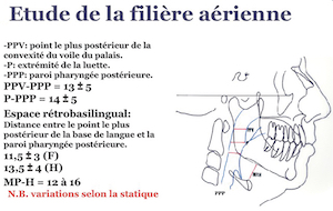 Etude de la filière aérienne